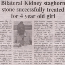 Bilateral Kidney Stag horn Successful